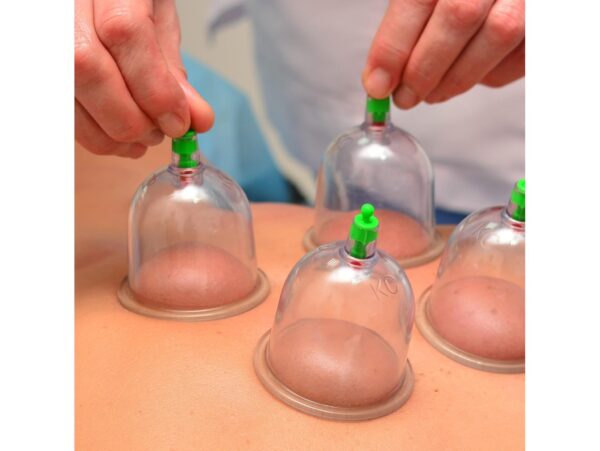 BAŃKI CHIŃSKIE PRÓŻNIOWE BEZOGNIOWE CELLULIT 12szt