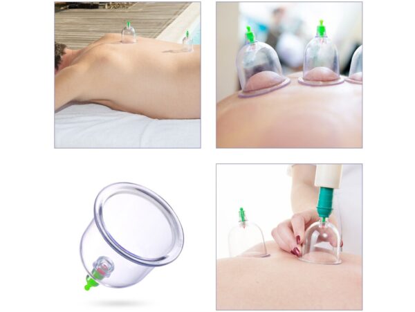 BAŃKI CHIŃSKIE PRÓŻNIOWE BEZOGNIOWE CELLULIT 12szt