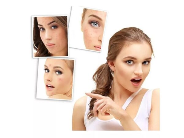 DARSONVAL DERMA WAND PIELĘGNACJA TWARZY OZONOWANIE